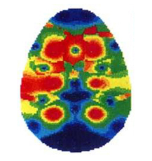 Neurobiologie und Flow - Eigene EEG-Studie zur Neurobiologie von Flow-Zuständen bei Golfern