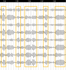 Neurobiologie und Flow - Eigene EEG-Studie zur Neurobiologie von Flow-Zuständen bei Musikern - Ergebnis 1: Starke Alpha-Aktivität und hohe Kohärenz